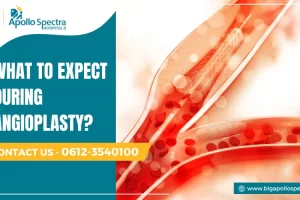 what to expect during angioplasty