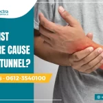 can wrist fracture cause carpal tunnel