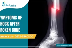 symptoms of shock after broken bone