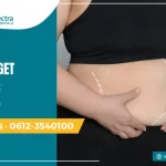 When to Get Bariatric Surgery