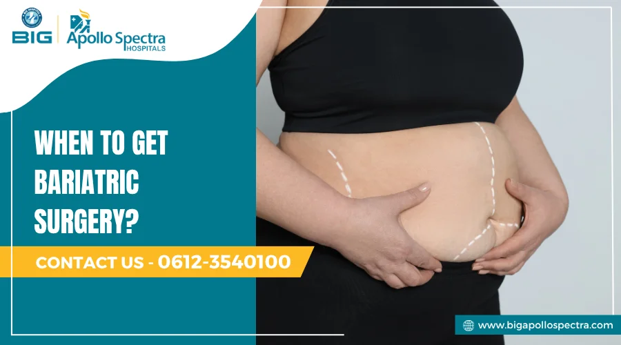 When to Get Bariatric Surgery