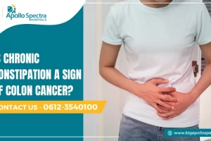 is chronic constipation a sign of colon cancer