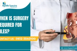 When is surgery required for piles