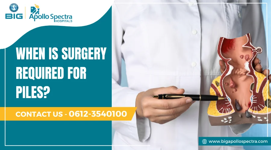 When is surgery required for piles