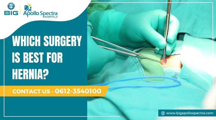 Which surgery is best for hernia