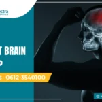 How to prevent brain stroke