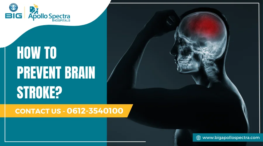 How to prevent brain stroke