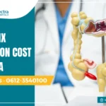 Appendix operation cost in Patna