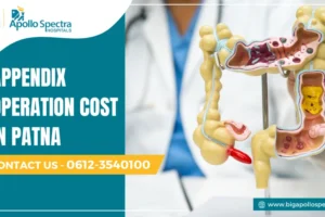Appendix operation cost in Patna