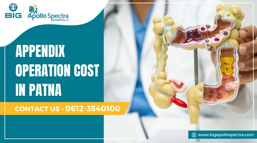 Appendix operation cost in Patna