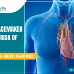 Does a pacemaker increase risk of stroke