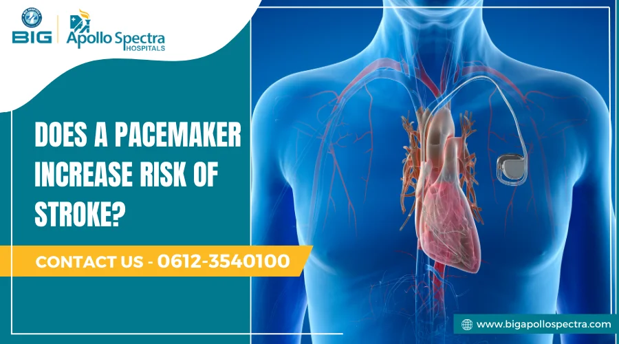 Does a pacemaker increase risk of stroke