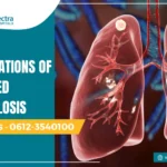 Complications of untreated tuberculosis