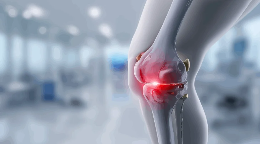 Arthritis specialist in Patna