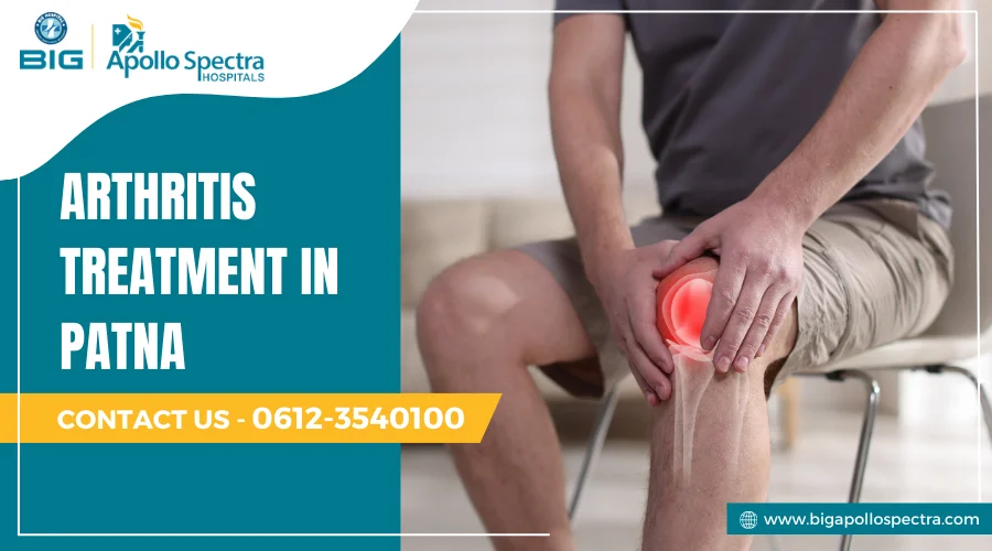Arthritis treatment in Patna