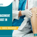 knee replacement surgery cost in Patna