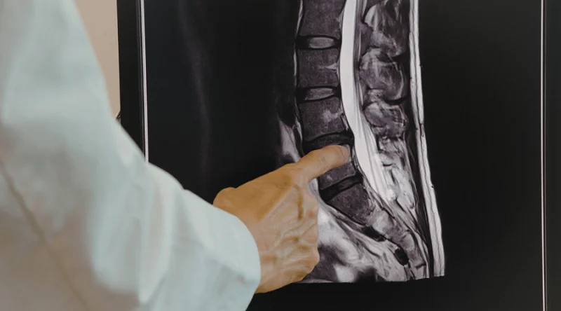 how is slip disc diagnosed