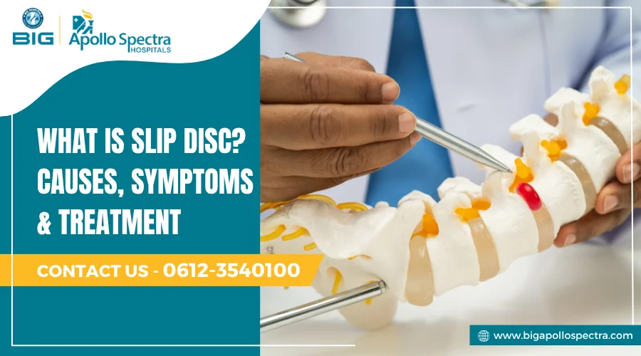 what is slip disc problem