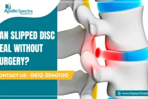 Can Slipped Disc Heal Without Surgery? Non-Surgical Treatments can slipped disc heal without surgery