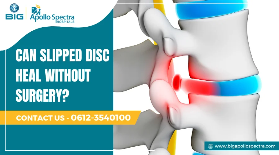 can slipped disc heal without surgery