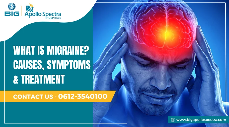 what is migraine