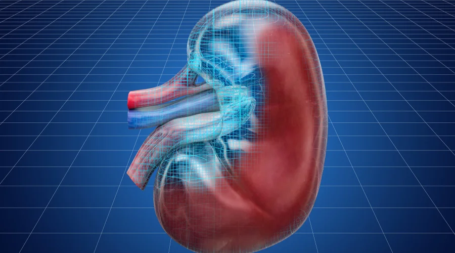 CKD
