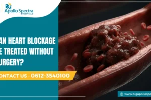Can Heart Blockage Be Treated Without Surgery