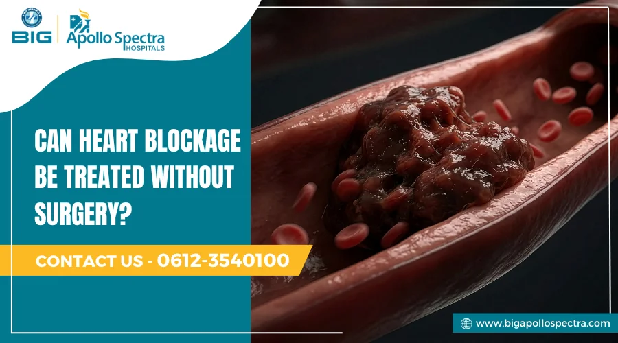 Can Heart Blockage Be Treated Without Surgery