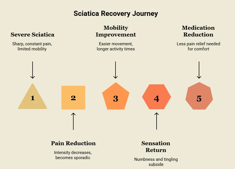 Signs Sciatica Is Improving