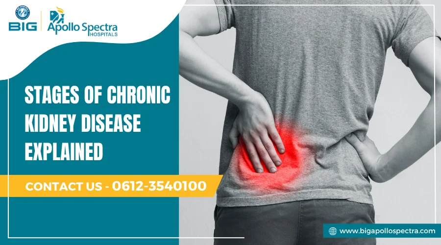 Stages of Chronic Kidney Disease