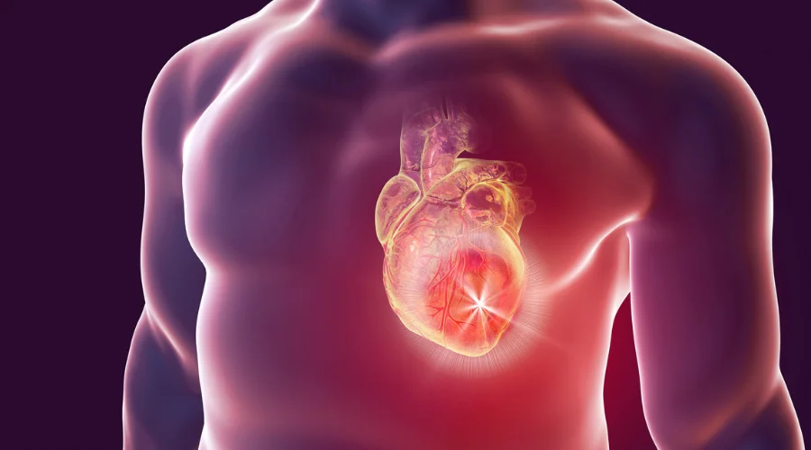 heart blockage