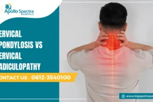 Cervical Spondylosis vs Cervical Radiculopathy