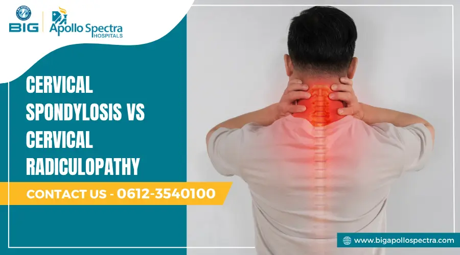 Cervical Spondylosis vs Cervical Radiculopathy