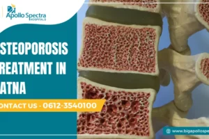 Osteoporosis Treatment in Patna