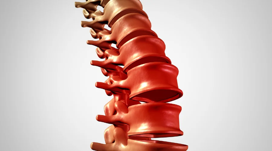 spine pain