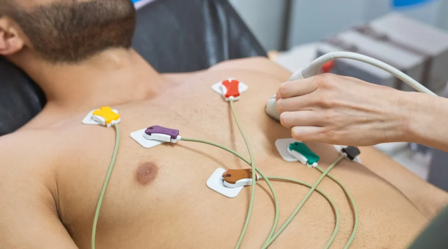 AFib diagnosis