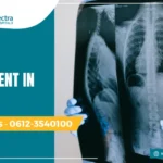 COPD treatment in patna