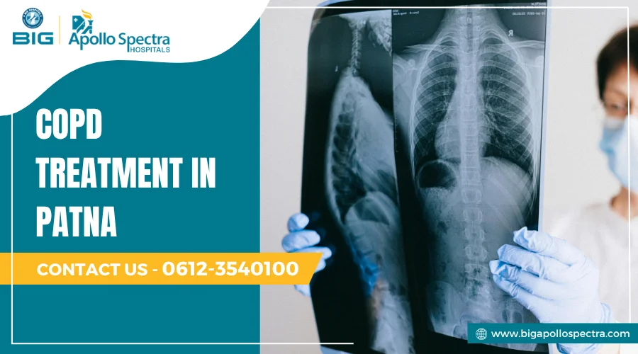 COPD treatment in patna