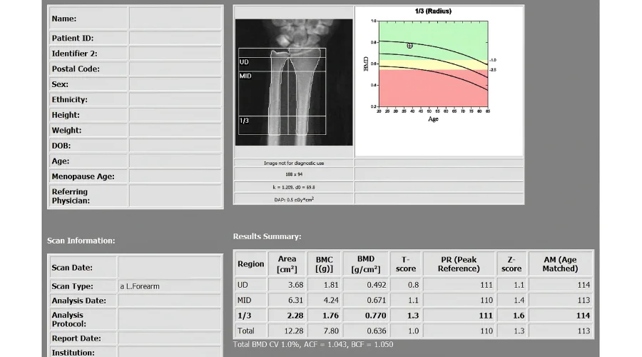 DEXA scan