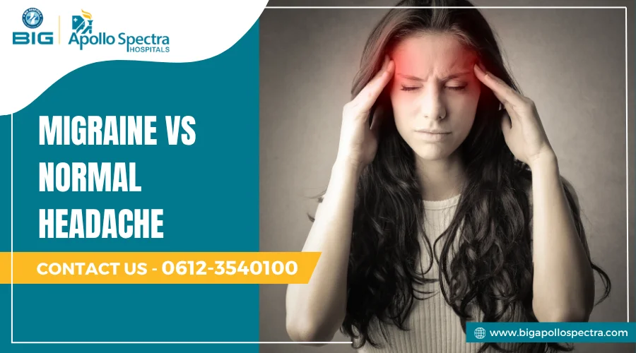 Migraine vs Normal Headache