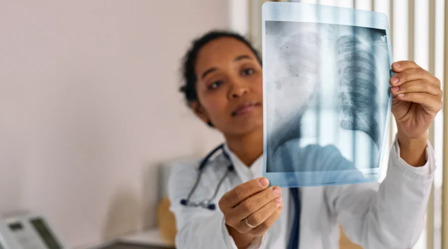 lung x ray