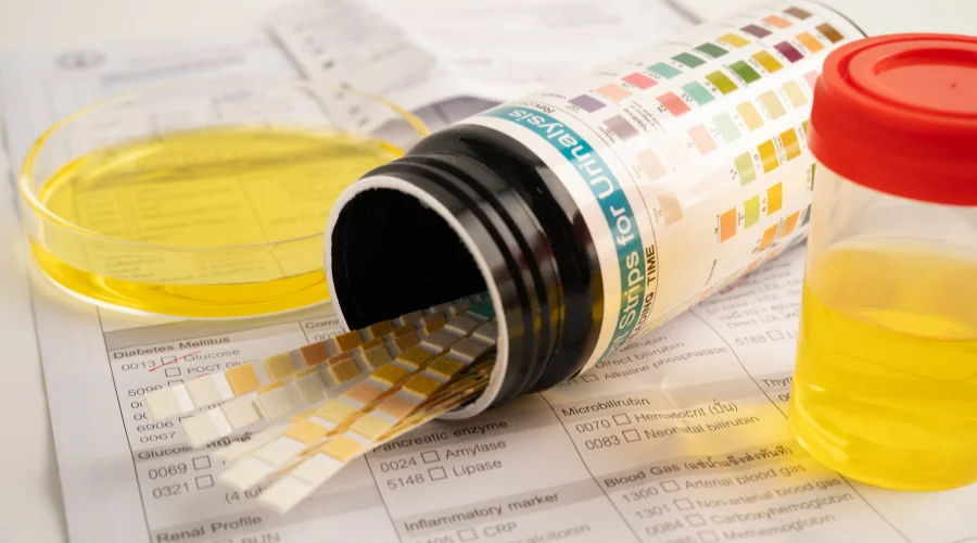 overactive bladder diagnosis