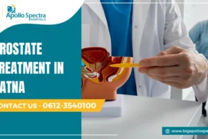 prostate treatment in patna