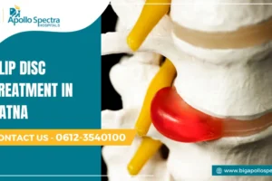 slip disc treatment in patna