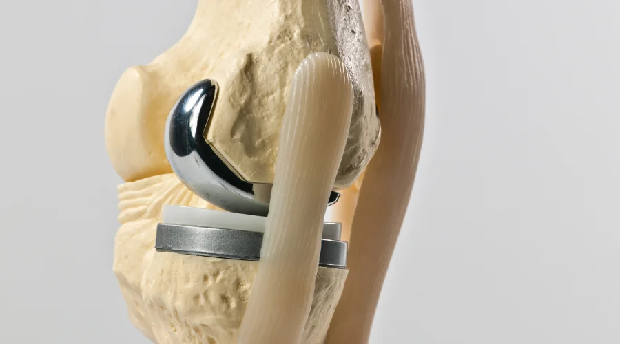 Benefits of Robotic Knee Replacement