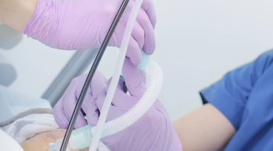 bronchoscopy procedure
